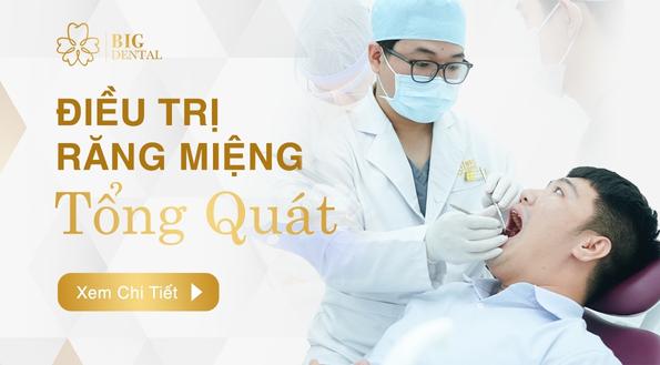 Điều trị răng miệng tổng quát