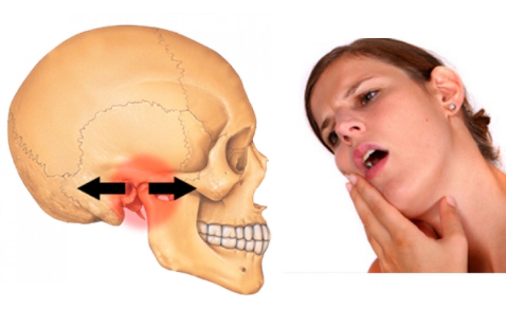 Ảnh hưởng đến thần kinh, đau khớp thái dương