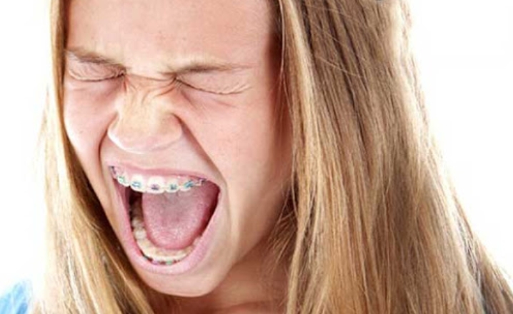 Niềng răng gây ra cảm giác khó chịu khi ăn và nhai