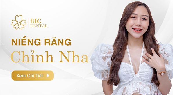 Niềng răng