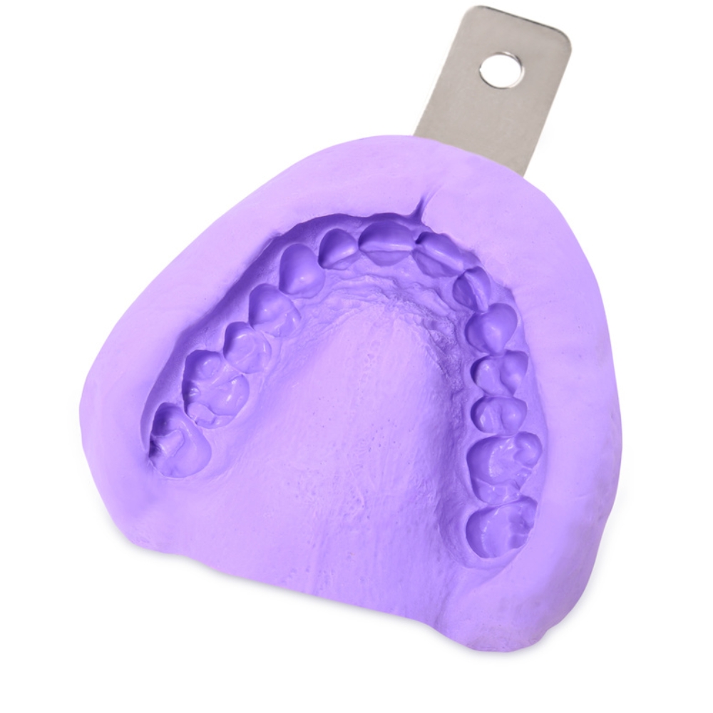 Trồng răng Implant