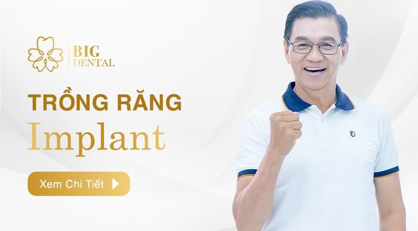 Trồng răng Implant